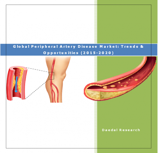 Global Peripheral Artery Disease Market (PAD) (2015-2020) - Business Research Reports