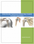 Global Shoulder Replacement Market Report: Size, Trends & Forecasts (2018-2022)
