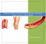 Global Peripheral Artery Disease Market (PAD) (2015-2020) - Business Research Reports